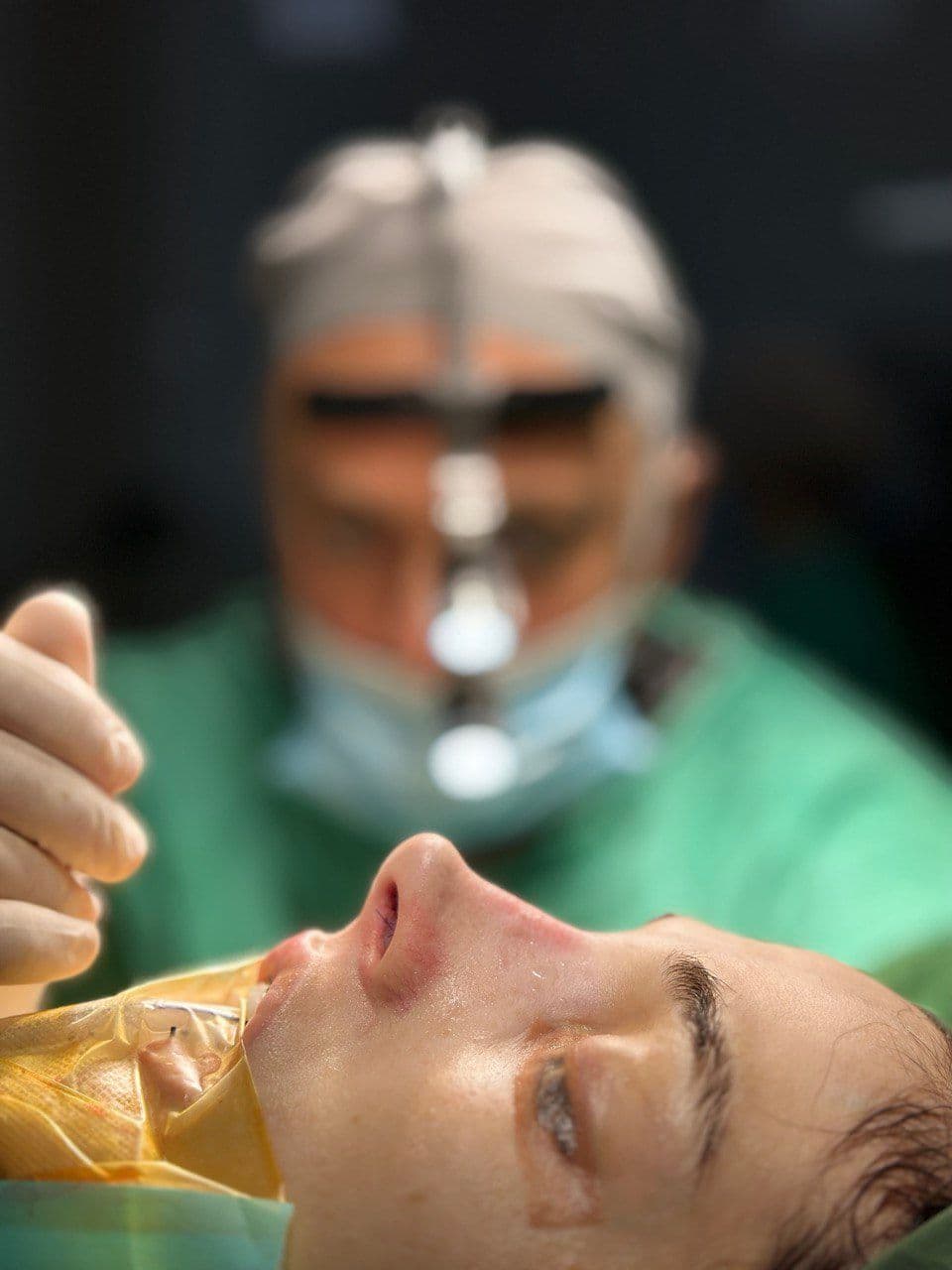 What is the difference between open and closed rhinoplasty?