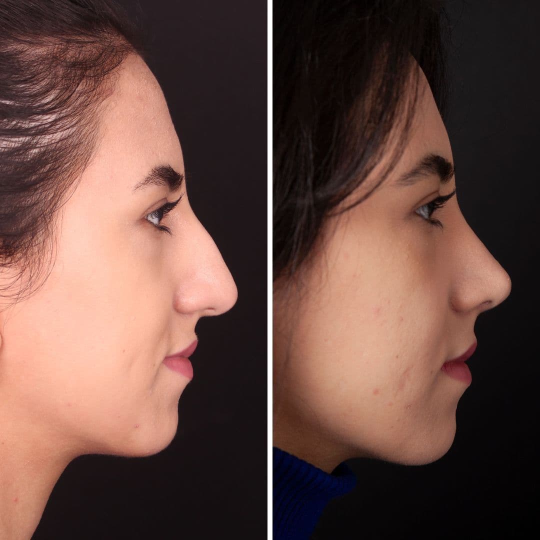 Əməliyyat əvvəli və sonrası